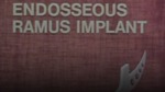 Endosseous Ramus Implant [198-?]