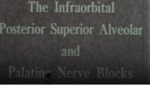 Infraorbital Posterior Superior Alveolar and Palatine Nerve Blocks [197-?] by Niels Bjorn Jorgensen DDS and John Hugnes MD