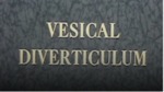 Vesical Diverticulum [197-?]